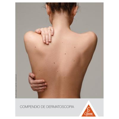 Compendio Dermatoscopia HEINE